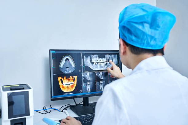 Best Broken or Chipped Tooth Repair in Channel Islands Beach, CA